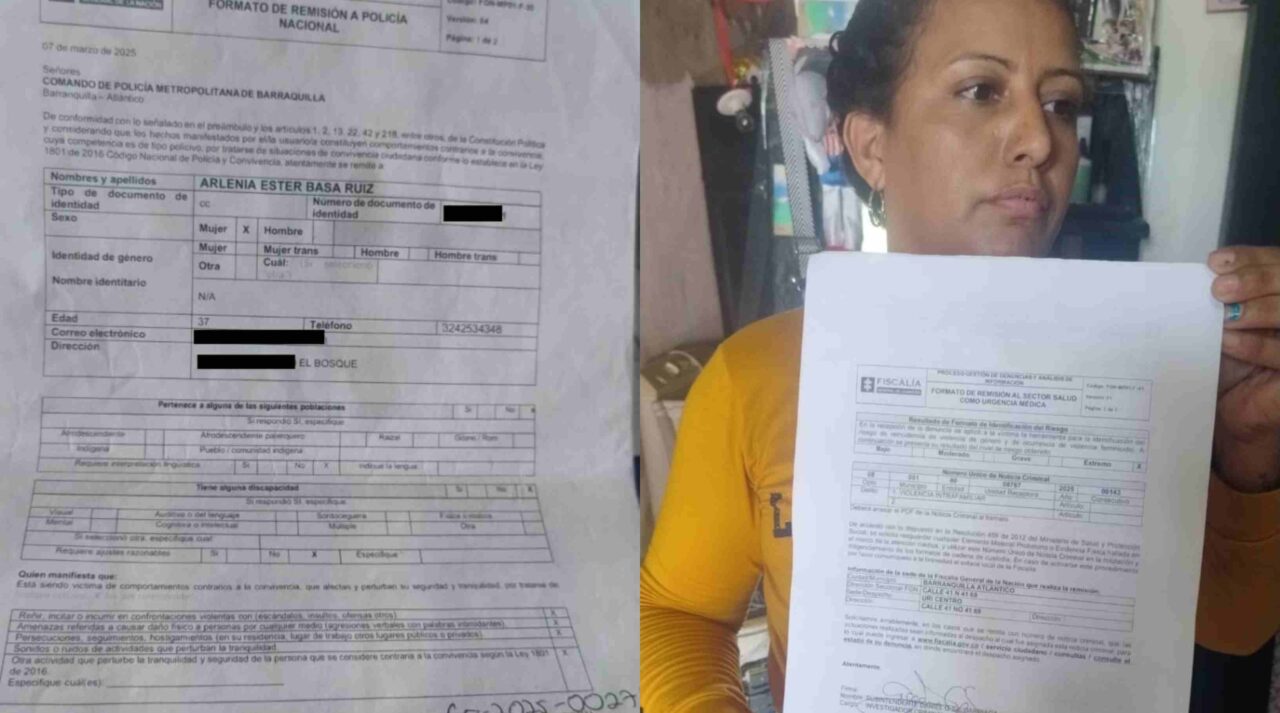 La señora quemó su exhusband con lentes hirviendo